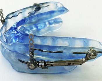 orthese-davancee-mandibulaire (1)